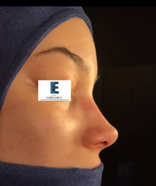 Slider image (4) Dr. Emin Eren Clinic